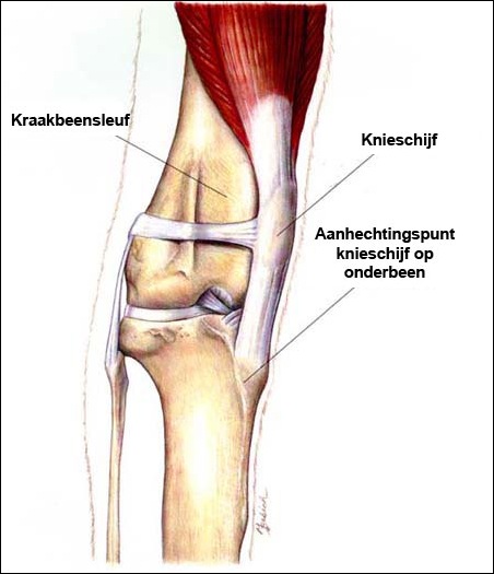 patella-luxatie